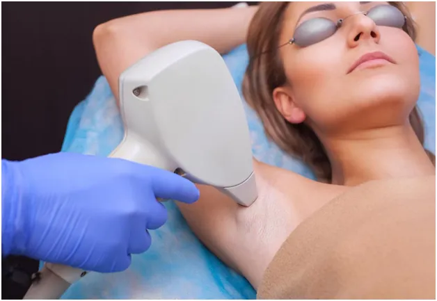 laser hair removal